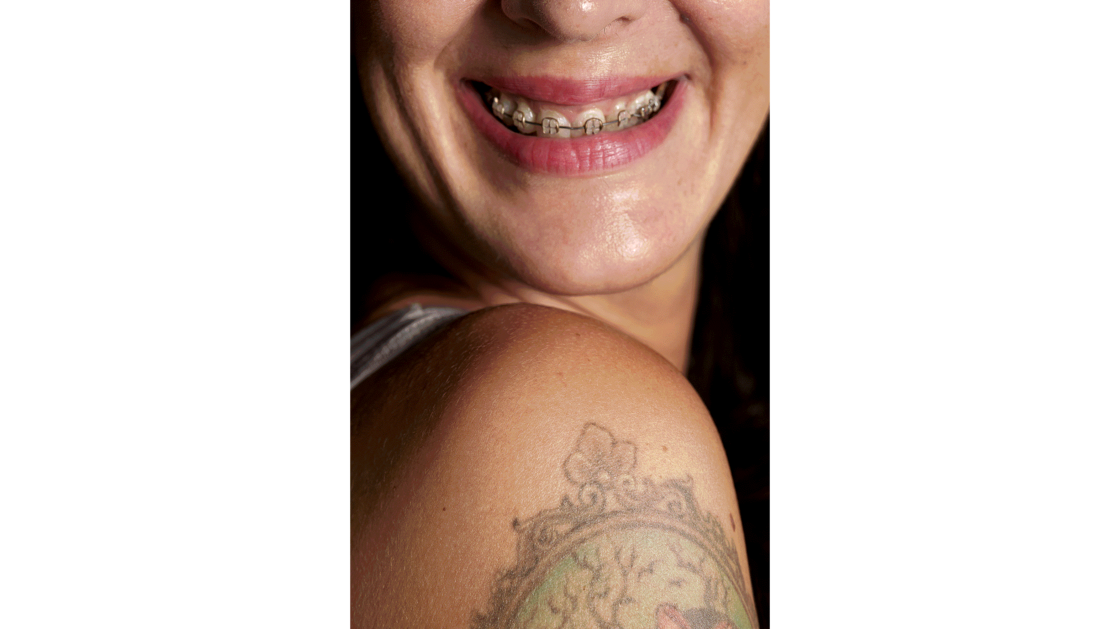 J’ai économisé pendant longtemps pour me faire redresser les dents. Maintenant, je porte mon appareil avec fierté! | © Photo: Marie-Christine Gerber | Styling: Filipa Fernandes